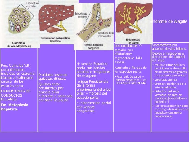 Sindrome de bilis espesa pdf file