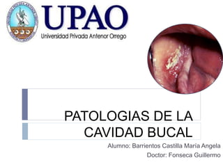 PATOLOGIAS DE LA 
CAVIDAD BUCAL 
Alumno: Barrientos Castilla María Angela 
Doctor: Fonseca Guillermo 
 