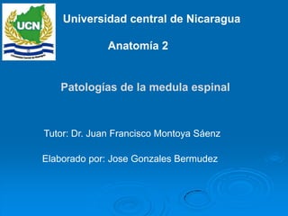 Universidad central de Nicaragua

              Anatomía 2


   Patologías de la medula espinal



Tutor: Dr. Juan Francisco Montoya Sáenz

Elaborado por: Jose Gonzales Bermudez
 