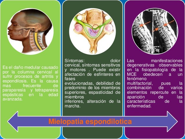 Patologias de la medula