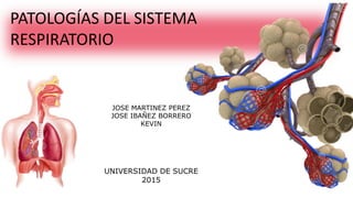 PATOLOGÍAS DEL SISTEMA
RESPIRATORIO
JOSE MARTINEZ PEREZ
JOSE IBAÑEZ BORRERO
KEVIN
UNIVERSIDAD DE SUCRE
2015
 