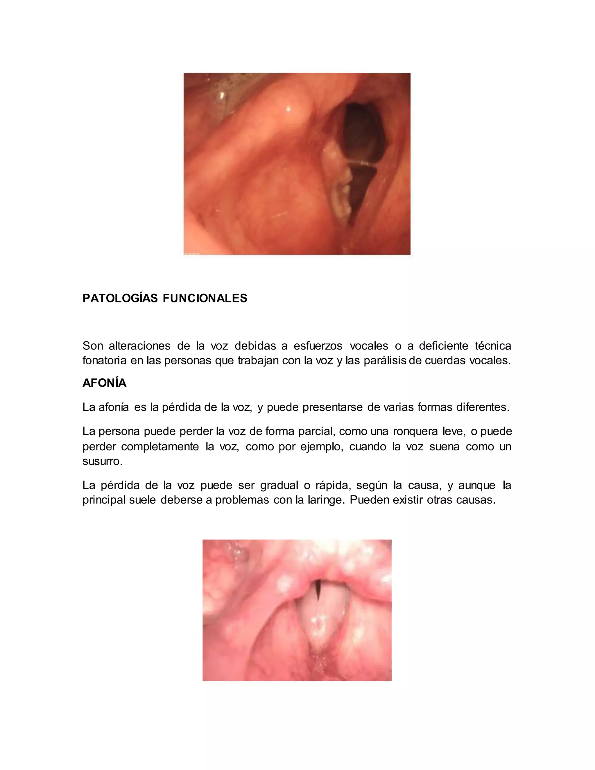 Patologias de la voz | DOCX
