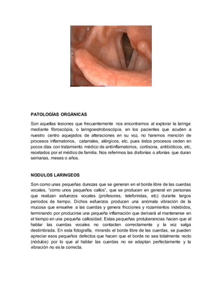 PATOLOGÍAS ORGÁNICAS
Son aquellas lesiones que frecuentemente nos encontramos al explorar la laringe
mediante fibroscópia, o laringoestroboscópia, en los pacientes que acuden a
nuestro centro aquejados de alteraciones en su voz, no haremos mención de
procesos inflamatorios, catarrales, alérgicos, etc. pues éstos procesos ceden en
pocos días con tratamiento médico de antiinflamatorios, cortisona, antibióticos, etc,
recetados por el médico de familia. Nos referimos las disfonías o afonías que duran
semanas, meses o años.
NODULOS LARINGEOS
Son como unas pequeñas durezas que se generan en el borde libre de las cuerdas
vocales, “como unos pequeños callos”, que se producen en general en personas
que realizan esfuerzos vocales (profesores, telefonistas, etc) durante largos
periodos de tiempo. Dichos esfuerzos producen una anómala vibración de la
mucosa que envuelve a las cuerdas y genera fricciones y rozamientos indebidos,
terminando por producirse una pequeña inflamación que derivará al mantenerse en
el tiempo en una pequeña callosidad. Estas pequeñas protuberancias hacen que al
hablar las cuerdas vocales no contacten correctamente y la voz salga
destimbrada. En esta fotografía, mirando el borde libre de las cuerdas, se pueden
apreciar esos pequeños defectos que hacen que el borde no sea totalmente recto
(nódulos) por lo que al hablar las cuerdas no se adaptan perfectamente y la
vibración no es la correcta.
 