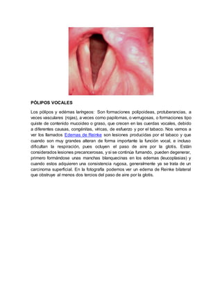 PÓLIPOS VOCALES
Los pólipos y edémas laríngeos: Son formaciones polipoideas, protuberancias, a
veces vasculares (rojas), a veces como papilomas, o verrugosas, o formaciones tipo
quiste de contenido mucoideo o graso, que crecen en las cuerdas vocales, debido
a diferentes causas, congénitas, víricas, de esfuerzo y por el tabaco. Nos vamos a
ver los llamados Edemas de Reinke son lesiones producidas por el tabaco y que
cuando son muy grandes alteran de forma importante la función vocal, e incluso
dificultan la respiración, pues ocluyen el paso de aire por la glotis. Están
considerados lesiones precancerosas, y si se continúa fumando, pueden degenerar,
primero formándose unas manchas blanquecinas en los edemas (leucoplasias) y
cuando estos adquieren una consistencia rugosa, generalmente ya se trata de un
carcinoma superficial. En la fotografía podemos ver un edema de Reinke bilateral
que obstruye al menos dos tercios del paso de aire por la glotis.
 
