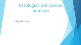 Patologias del cuerpo
humano
Diego Buitrago
 