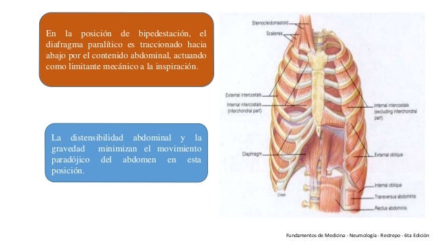 Patologias del diafragma