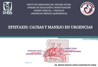 INSTITUTO MEXICANO DEL SEGURO SOCIAL
UNIDAD DE EDUCACIÓN E INVESTIGACIÓN
HGZMF ZONA No. 1 PACHUCA
URGENCIAS MÉDICO QUIRÚRGICAS
EPISTAXIS: CAUSAS Y MANEJO EN URGENCIAS
DR. IBRAIM IGNACIO LOYOLA MARTINEZ R2 UMQX
 