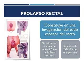 PROLAPSO RECTAL
Constituye en una
invaginación del todo
espesor del recto
Se inicia por
encima de
unos 7.5 cm
de la línea
pectínea
Se extiende
más allá del
margen anal
 