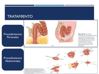 TRATAMIENTO
• Se dirigen a apretar el ano con una diversidad
de materiales prostéticos,rizar la mucosa
rectal (procedimiento de Delorme)
• Resecación el intestino prolapsado del perineo
rectosigmoidectomía perineal o procedimiento
de Altemeier)
Procedimientos
Perianales
• Es la reparación más durable y las recurrencias
aparecen en menos de 10% de los enfermos.
• Reducción de la herniaperineal y cierre del fondo
del saco (reparación de Moschcowitz)
• Fijación del recto con un cabestrillo de prótesis
(rectopexia de Ripstein y Wells)o mediante
rectopexia con sutura
• Resección del colon sigmoide redundante
Procedimientos
Abdominales
 