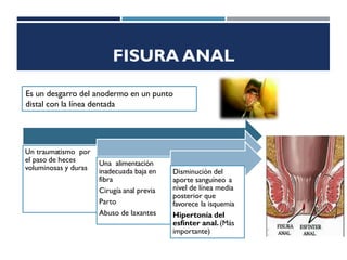 FISURA ANAL
Un traumatismo por
el paso de heces
voluminosas y duras
Una alimentación
inadecuada baja en
fibra
Cirugía anal previa
Parto
Abuso de laxantes
Disminución del
aporte sanguíneo a
nivel de línea media
posterior que
favorece la isquemia
Hipertonía del
esfínter anal.(Más
importante)
Es un desgarro del anodermo en un punto
distal con la línea dentada
 