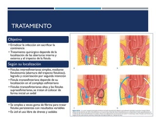 TRATAMIENTO
Objetivo
• Erradicar la infección sin sacrificar la
continencia
• Tratamiento quirúrgico depende de la
localización de las aberturas interna y
externa y el trayecto de la fístula.
Según su localización
• Fístulas interesfinterianas simples, mediante
fistulotomía (abertura del trayecto fistuloso),
legrado y cicatrización por segunda intención
• Fístula transesfinteriana depende de su
localización en el complejo esfinteriano
• Fístulas transesfinterianas altas y las fístulas
supraesfinterianas,se tratan al colocar de
forma inicial un sedal
• Se emplea a veces goma de fibrina para tratar
fístulas persistentes con resultados variables
• Es útil el uso libre de drenes y sedales
 