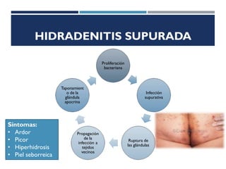 HIDRADENITIS SUPURADA
Proliferación
bacteriana
Infección
supurativa
Ruptura de
las glándulas
Propagación
de la
infección a
tejidos
vecinos
Taponamient
o de la
glándula
apocrina
Síntomas:
• Ardor
• Picor
• Hiperhidrosis
• Piel seborreica
 