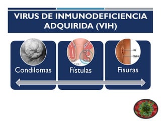VIRUS DE INMUNODEFICIENCIA
ADQUIRIDA (VIH)
Condilomas Fístulas Fisuras
 