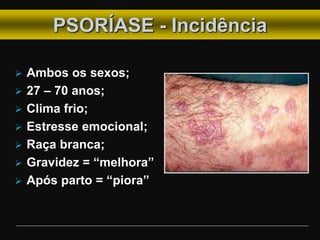  Ambos os sexos;
 27 – 70 anos;
 Clima frio;
 Estresse emocional;
 Raça branca;
 Gravidez = “melhora”
 Após parto = “piora”
PSORÍASE - Incidência
 