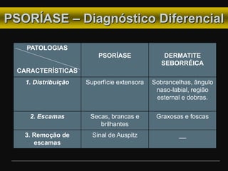 PSORÍASE – Diagnóstico Diferencial
PATOLOGIAS
CARACTERÍSTICAS
PSORÍASE DERMATITE
SEBORRÉICA
1. Distribuição Superfície extensora Sobrancelhas, ângulo
naso-labial, região
esternal e dobras.
2. Escamas Secas, brancas e
brilhantes
Graxosas e foscas
3. Remoção de
escamas
Sinal de Auspitz __
 