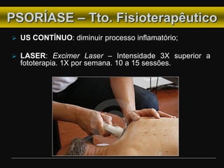  US CONTÍNUO: diminuir processo inflamatório;
 LASER: Excimer Laser – Intensidade 3X superior a
fototerapia. 1X por semana. 10 a 15 sessões.
PSORÍASE – Tto. Fisioterapêutico
 