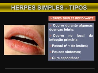 HERPES SIMPLES - TIPOS
HERPES SIMPLES RECIDIVANTE
 Ocorre durante algumas
doenças febris;
 Ocorre no local da
infecção primária;
Possui nº < de lesões;
Poucos sintomas;
Cura espontânea.
 