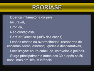 PSORÍASE
 Doença inflamatória da pele,
 Incurável,
 Crônica,
 Não contagiosa,
 Caráter Genético (30% dos casos).
 Lesões róseas ou avermelhadas, recobertas de
escamas secas, esbranquiçadas e descamativas,
 Localização: couro cabeludo, cotovelos e joelhos.
 Surge principalmente antes dos 30 e após os 50
anos, mas em 15% = infância.
 