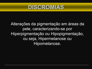 DISCROMIAS
Alterações da pigmentação em áreas da
pele, caracterizando-se por
Hiperpigmentação ou Hipopigmentação,
ou seja, Hipermelanose ou
Hipomelanose.
 