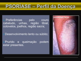 PSORÍASE – Perfil da Doença
 Preferências pelo couro
cabeludo, unhas, região tibial,
cotovelos, joelhos, região sacra;
Desenvolvimento lento ou súbito;
Prurido e queimação podem
estar presentes.
 
