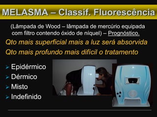 MELASMA – Classif. Fluorescência
(Lâmpada de Wood – lâmpada de mercúrio equipada
com filtro contendo óxido de níquel) – Prognóstico.
Qto mais superficial mais a luz será absorvida
Qto mais profundo mais difícil o tratamento
 Epidérmico
 Dérmico
 Misto
 Indefinido
 