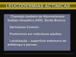 LEUCODERMIAS ACTÍNICAS
 Chamada também de Hipomelanose
Guttata Idiopática (HGI), Sarda Branca;
Dermatose Comum;
Predomínio em indivíduos adultos;
Localização – superfície extensora de
antebraço e pernas;
 