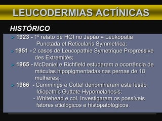 LEUCODERMIAS ACTÍNICAS
 1923 - 1º relato de HGI no Japão = Leukopatia
Punctada et Reticularis Symmetrica;
 1951 - 2 casos de Leucopathie Symetrique Progressive
des Extremités;
 1965 - McDaniel e Richfield estudaram a ocorrência de
máculas hipopigmentadas nas pernas de 18
mulheres;
 1966 - Cummings e Cottel denominaram esta lesão
Idiopathic Guttate Hypomelanosis;
- Whitehead e col. Investigaram os possíveis
fatores etiológicos e histopatológicos.
HISTÓRICO
 