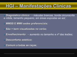 HGI – Manifestações Clínicas
 Diagnóstico clínico → máculas brancas, borda circunscrita
e nítida, tamanho pequeno, em áreas expostas ao sol;
 MMSS E MMII sedes preferenciais;
 São + bem visualizadas no verão;
 Envelhecimento → aumento no tamanho e nº das lesões;
 Desconforto estético;
 Comum a todas as raças;
 