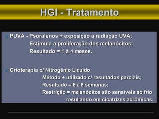 HGI - Tratamento
 PUVA - Psoralenos + exposição a radiação UVA;
Estimula a proliferação dos melanócitos;
Resultado = 1 à 4 meses.
 Crioterapia c/ Nitrogênio Líquido
Método + utilizado c/ resultados parciais;
Resultado = 6 à 8 semanas;
Restrição = melanócitos são sensíveis ao frio
resultando em cicatrizes acrômicas.
 