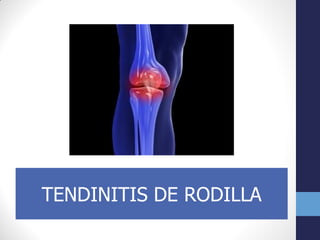 Patologias de rodilla | PDF
