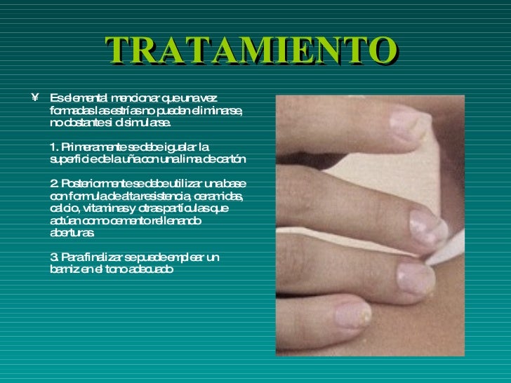 A que médico es necesario ir con el hongo de las uñas