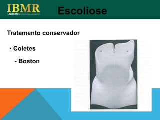 Tratamento conservador
Escoliose
• Coletes
- Boston
 
