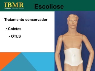 Tratamento conservador
Escoliose
• Coletes
- OTLS
 