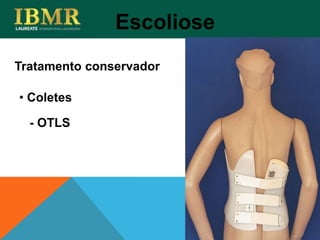 Tratamento conservador
Escoliose
• Coletes
- OTLS
 