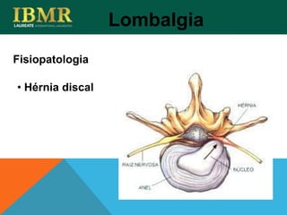 Fisiopatologia
Lombalgia
• Hérnia discal
 