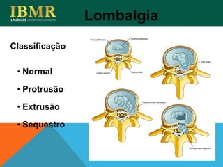 Classificação
Lombalgia
• Normal
• Protrusão
• Extrusão
• Sequestro
 