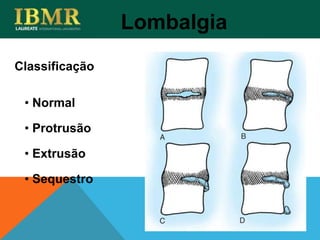 Classificação
Lombalgia
• Normal
• Protrusão
• Extrusão
• Sequestro
 