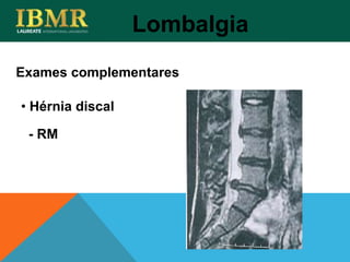 Exames complementares
Lombalgia
• Hérnia discal
- RM
 