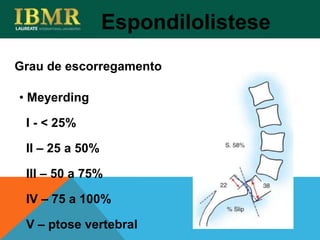 Espondilolistese
Grau de escorregamento
• Meyerding
I - < 25%
II – 25 a 50%
III – 50 a 75%
IV – 75 a 100%
V – ptose vertebral
 