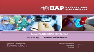Tema: PATOLOGÍAS DENTARIAS
Docente: Mg. C.D. Verónica Farfán Heredia
2017-II B
IV
llI
 