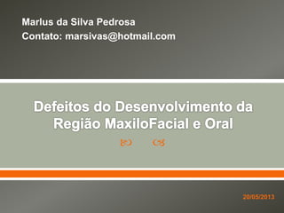  
Marlus da Silva Pedrosa
Contato: marsivas@hotmail.com
20/05/2013
 