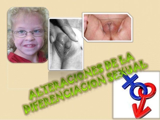 Patologia seudo hermafroditismo