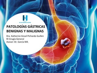 PATOLOGÍAS GÁSTRICAS
BENIGNAS Y MALIGNAS
Dra. Katherine Gissel Pichardo Guillen
RI Cirugía General
Asesor: Dr. García MA
 