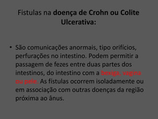 Fistulas na doença de Crohn ou Colite
Ulcerativa:
• São comunicações anormais, tipo orifícios,
perfurações no intestino. Podem permitir a
passagem de fezes entre duas partes dos
intestinos, do intestino com a bexiga, vagina
ou pele. As fístulas ocorrem isoladamente ou
em associação com outras doenças da região
próxima ao ânus.
 