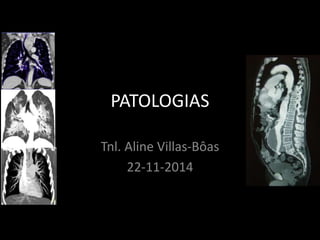 PATOLOGIAS
Tnl. Aline Villas-Bôas
22-11-2014
 