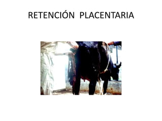 RETENCIÓN PLACENTARIA
 