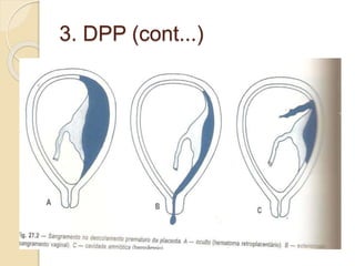 3. DPP (cont...) 
 Hermognes 
 274 fig 27.2 
 
