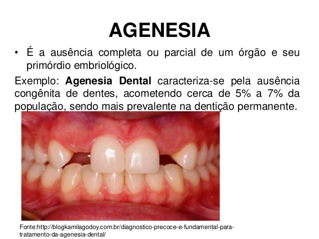 Patologia slide