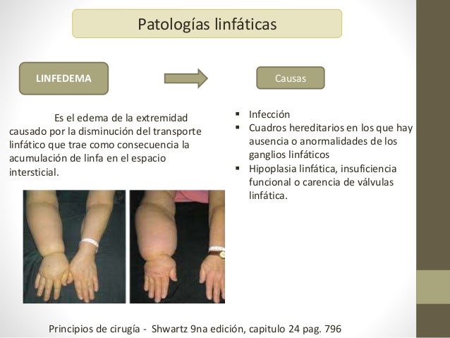Patologias linfaticas