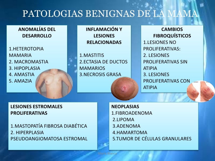 Patologias mamarias benignas MYBP